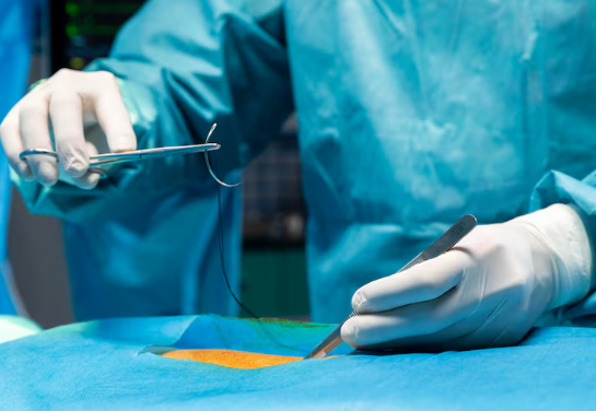 Hernia surgery Bangalore